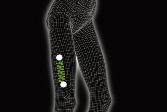 一般的なEMSイメージ