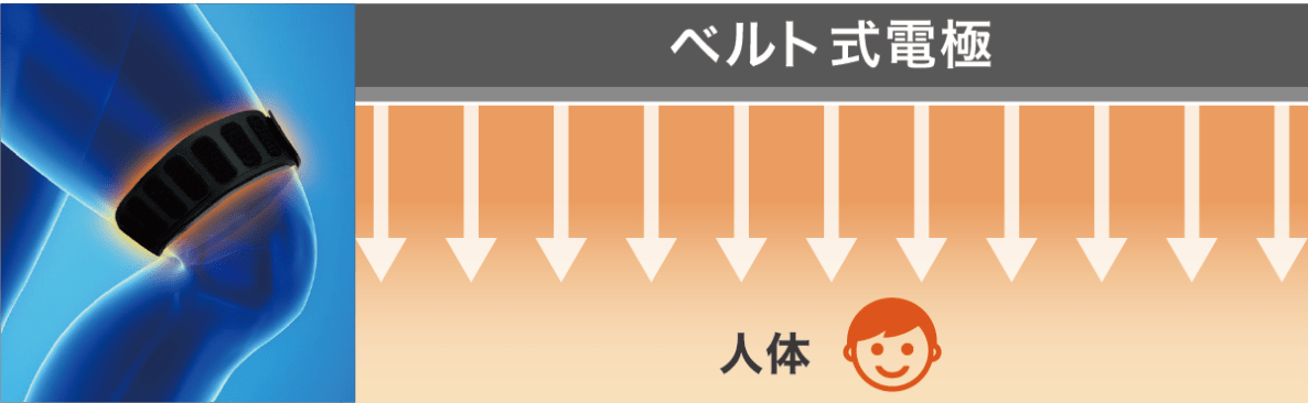 ベルト式電極